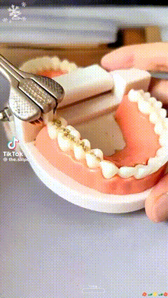 Broche a dent 3 têtes